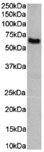 Angiotensin II Chimeric Antibody in Western Blot (WB)