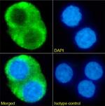 CRP Chimeric Antibody in Immunocytochemistry (ICC/IF)