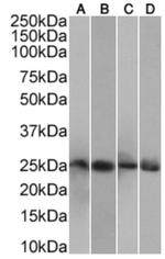 CRP Chimeric Antibody in Western Blot (WB)