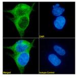 Mesothelin Antibody in Immunocytochemistry (ICC/IF)