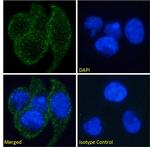 EDAR Antibody in Immunocytochemistry (ICC/IF)