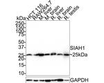 SIAH1 Antibody in Western Blot (WB)