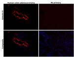 Galectin 9 Antibody in Immunohistochemistry (Paraffin) (IHC (P))