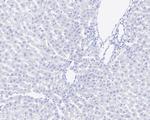 Cannabinoid Receptor 1 Antibody in Immunohistochemistry (Paraffin) (IHC (P))