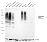 Cannabinoid Receptor 1 Antibody in Western Blot (WB)