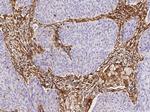 Galectin 1 Antibody in Immunohistochemistry (Paraffin) (IHC (P))