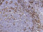 CD162 Antibody in Immunohistochemistry (Paraffin) (IHC (P))