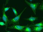 TNFR1 Antibody in Immunocytochemistry (ICC/IF)