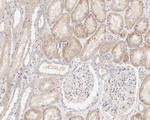 RAB1A Antibody in Immunohistochemistry (Paraffin) (IHC (P))