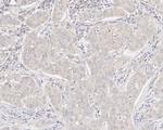 XIAP Antibody in Immunohistochemistry (Paraffin) (IHC (P))