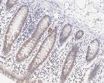 XIAP Antibody in Immunohistochemistry (Paraffin) (IHC (P))