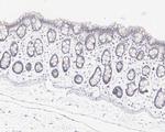 XIAP Antibody in Immunohistochemistry (Paraffin) (IHC (P))