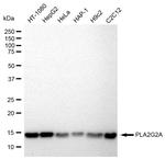 PLA2G2A Antibody in Western Blot (WB)