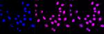 ACVR1 Antibody in Immunocytochemistry (ICC/IF)