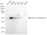 ACVR1 Antibody in Western Blot (WB)