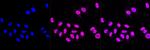 alpha Actinin 3 Antibody in Immunocytochemistry (ICC/IF)