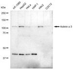 alpha Actinin 3 Antibody in Western Blot (WB)