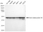 ACTR1B Antibody in Western Blot (WB)