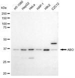 ABO Antibody in Western Blot (WB)