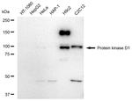 PKC mu Antibody in Western Blot (WB)