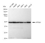 ATP5A1 Antibody in Western Blot (WB)