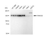 FANCD2 Antibody in Western Blot (WB)