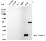 Cystatin A Antibody in Western Blot (WB)