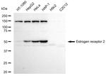 Estrogen Receptor beta Antibody in Western Blot (WB)