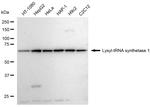 KARS Antibody in Western Blot (WB)