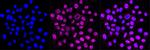 FOXO1 Antibody in Immunocytochemistry (ICC/IF)