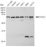 FOXO1 Antibody in Western Blot (WB)