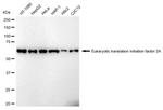 EIF2A Antibody in Western Blot (WB)