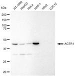 AGTR1 Antibody in Western Blot (WB)