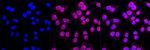 RAB9 Antibody in Immunocytochemistry (ICC/IF)