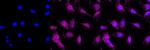 LC3A Antibody in Immunocytochemistry (ICC/IF)