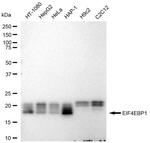 4EBP1 Antibody in Western Blot (WB)