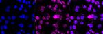 Phospho-DNA-PK (Ser2056) Antibody in Immunocytochemistry (ICC/IF)