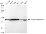 HAT1 Antibody in Western Blot (WB)