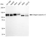 CD51 Antibody in Western Blot (WB)