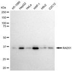 RAD51 Antibody in Western Blot (WB)