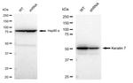 Cytokeratin 7 Antibody