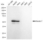 Cytokeratin 7 Antibody in Western Blot (WB)