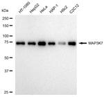 TAK1 Antibody in Western Blot (WB)