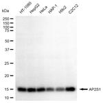 AP2S1 Antibody in Western Blot (WB)