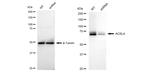 ACSL4 Antibody