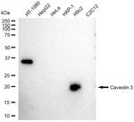 Caveolin 3 Antibody in Western Blot (WB)