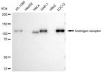 Androgen Receptor Antibody in Western Blot (WB)