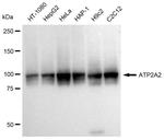 SERCA2 ATPase Antibody in Western Blot (WB)