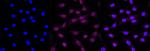 Cdc73 Antibody in Immunocytochemistry (ICC/IF)