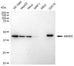 ABHD5 Antibody in Western Blot (WB)